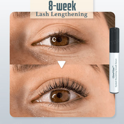 GlowVine™ Eyelash Nourishing Growth Serum